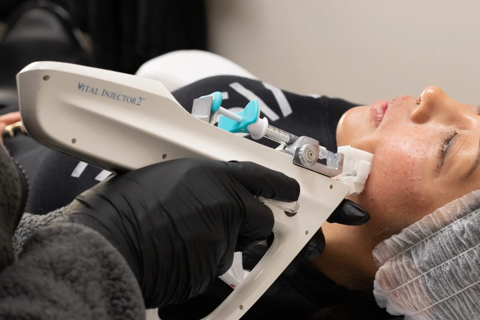 Microinjections-Treatment_8352.jpg