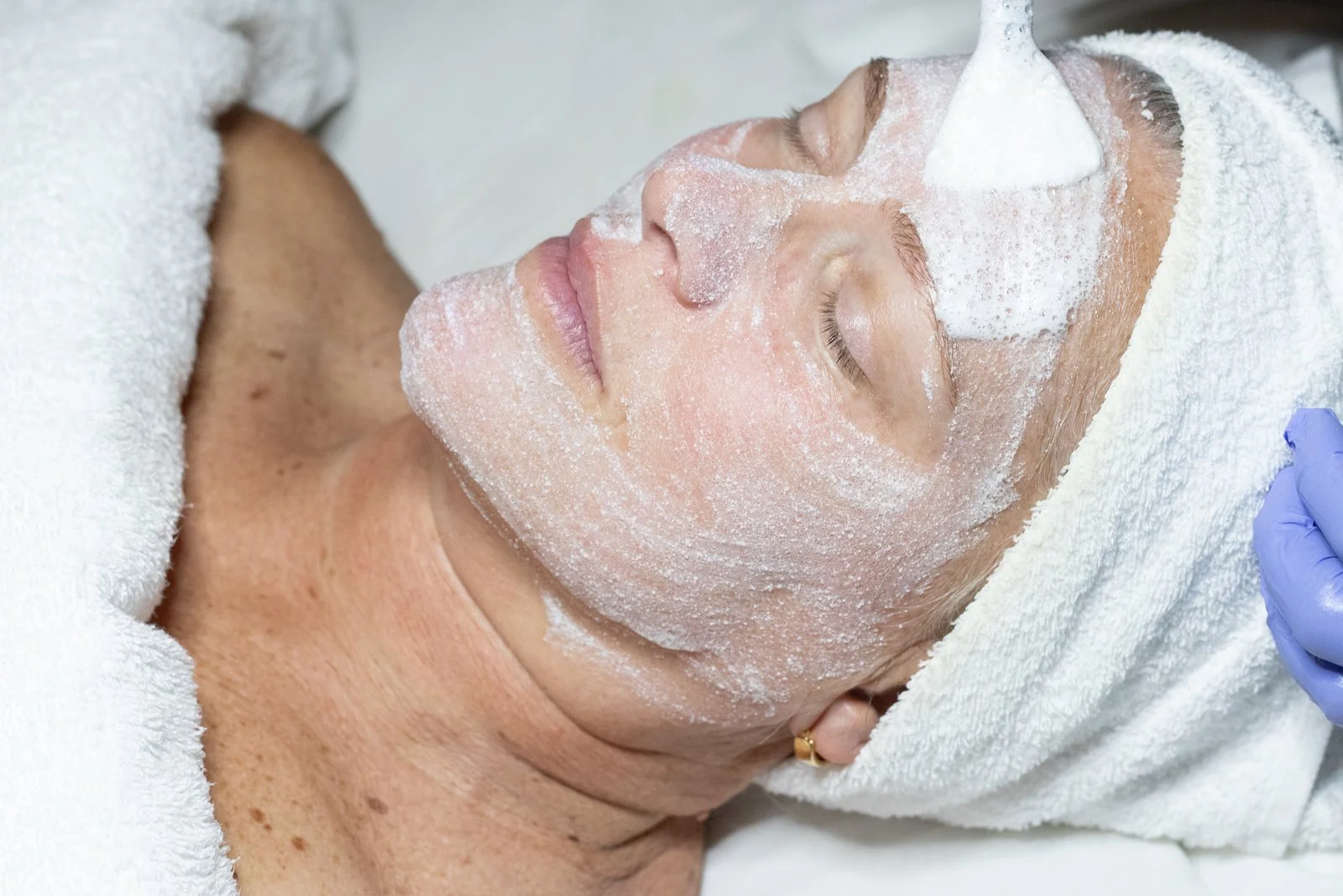 Regenerative Aesthetics vs Traditional Anti-Aging Treatments – What's the Difference?