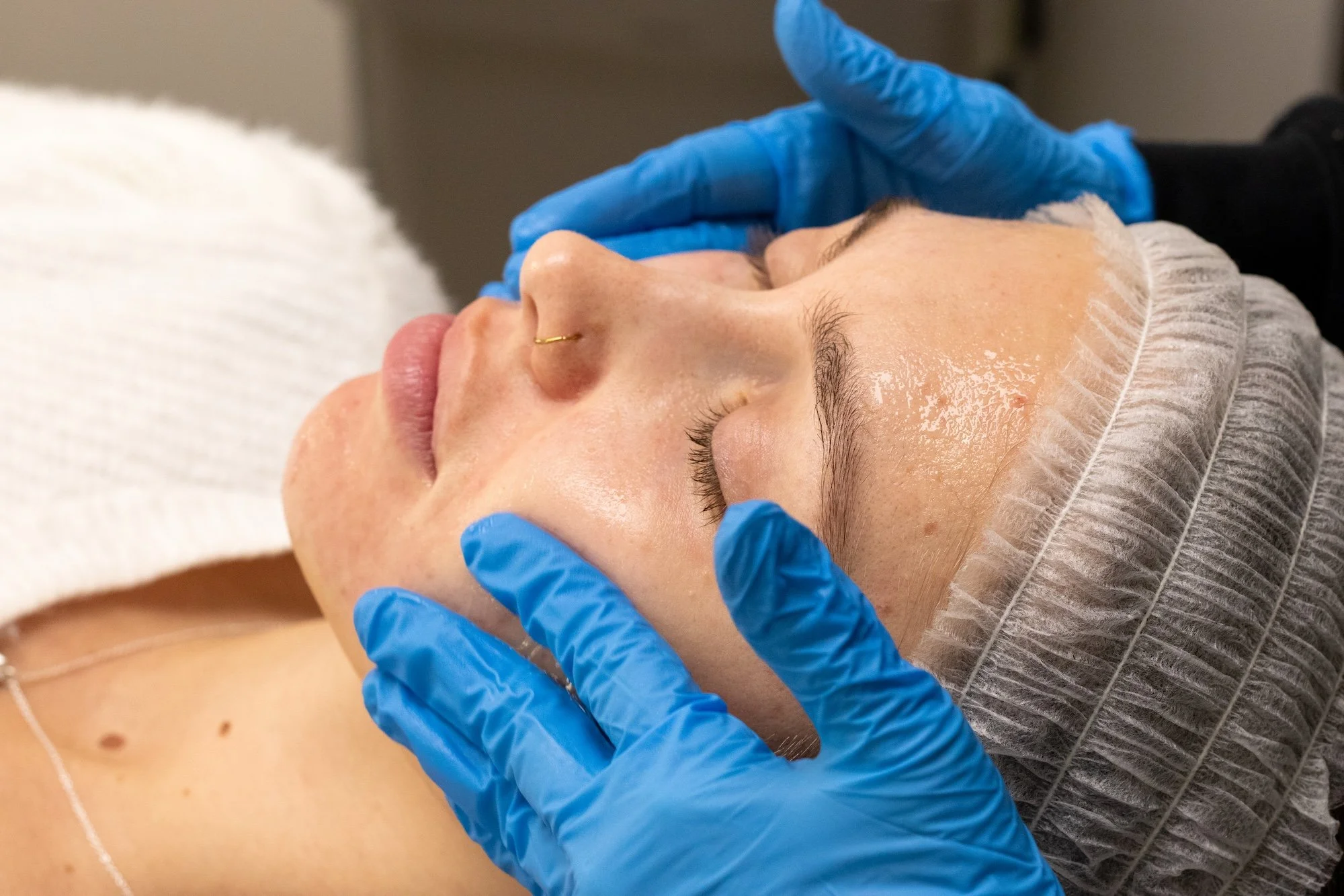A close-up of a woman's face as she receives a peptide skin treatment from a medical aesthetician wearing blue gloves at Grace Hill Salon and Spa in Winnipeg