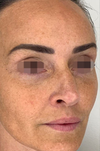 Close-up of a woman's face showing freckles and well-groomed eyebrows