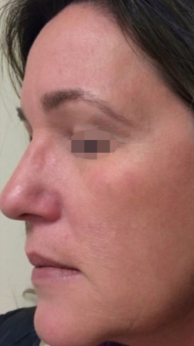 Close-up side profile of a woman's face showing skin texture and makeup.