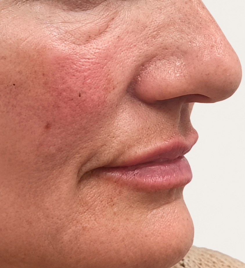 Close-up of a person's side face showing skin pores and lip details.