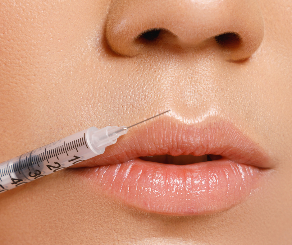 Close-up of a person's lips with a syringe near the upper lip, about to inject into the lip.