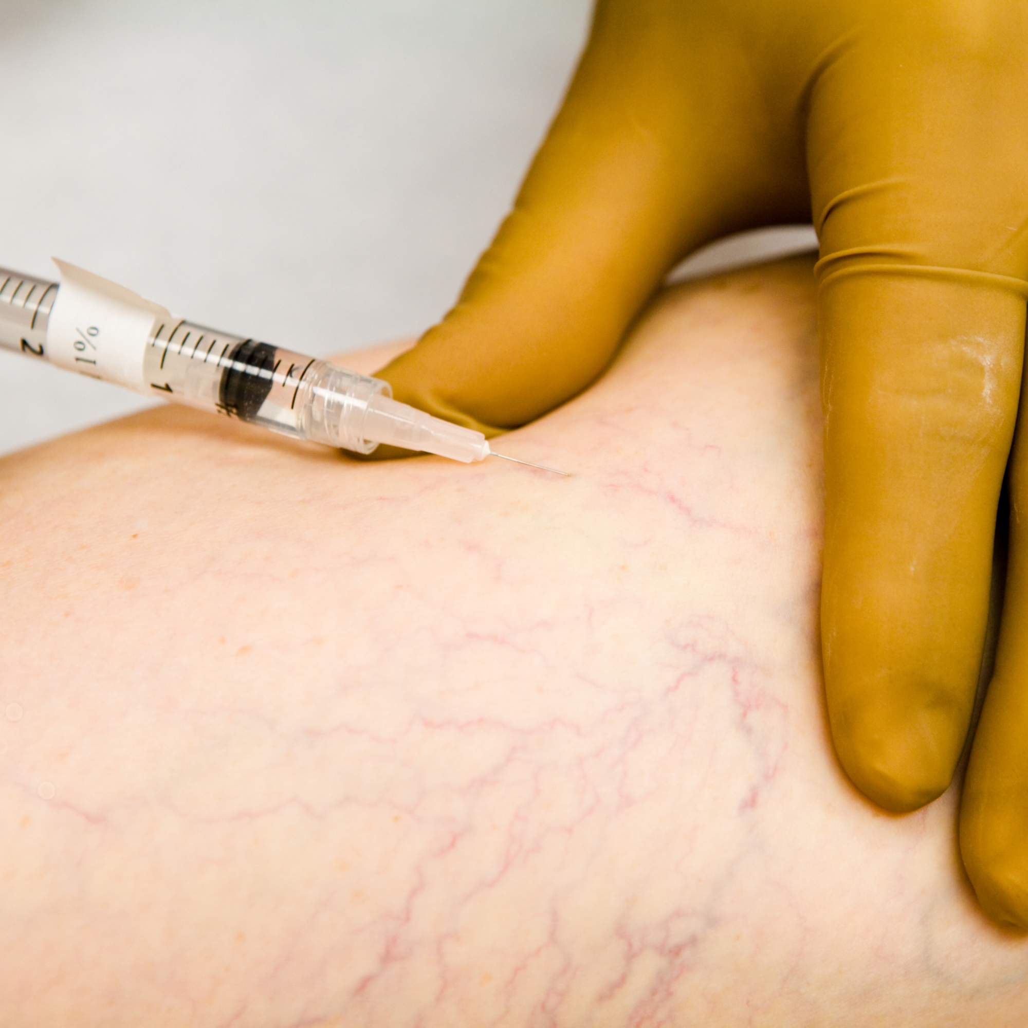 Close-up of a person receiving a vaccination injection in their upper arm using a syringe with a needle.