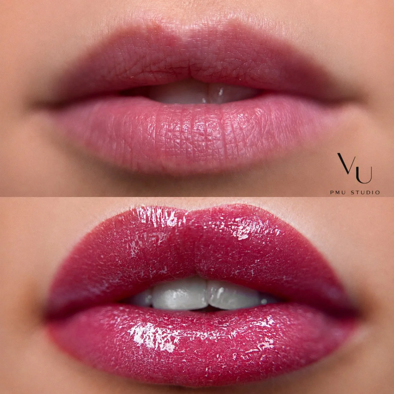 LIP PIGMENTATIE