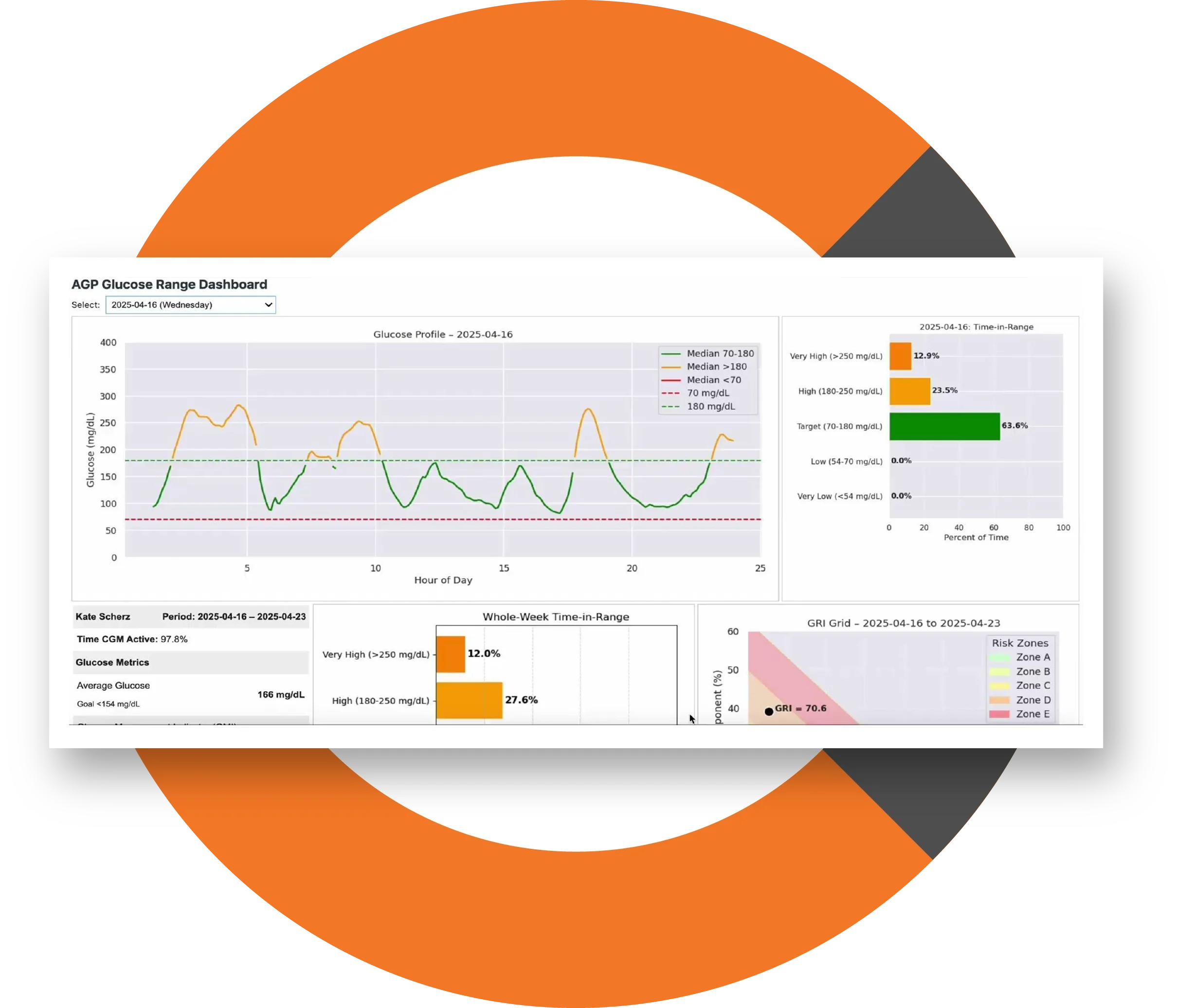 Dashboard of the Jupyter Health application on a computer screen showing some charts and graphs of a patient's health
