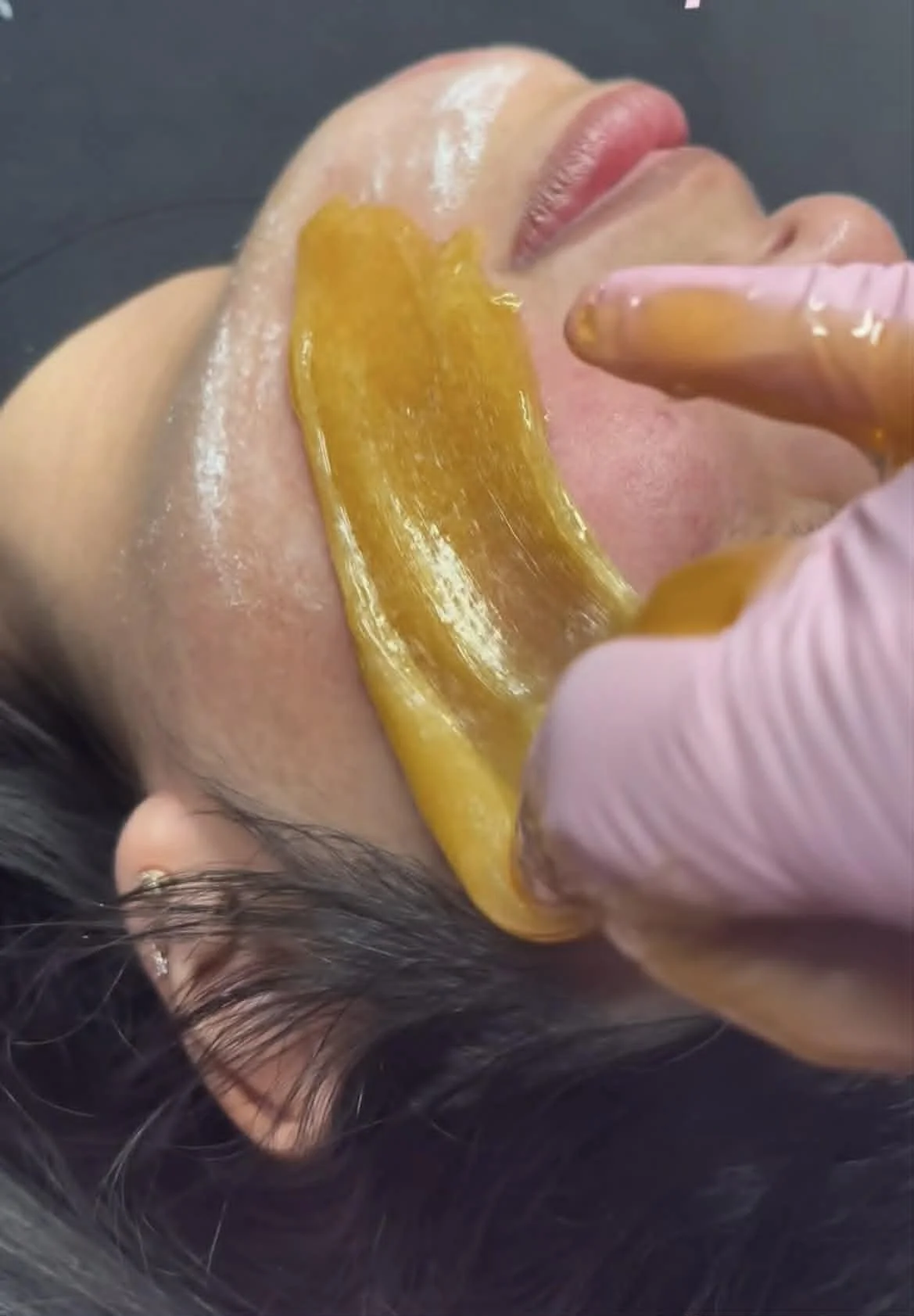A person receiving a facial treatment with a yellow gel applied to their face, while a practitioner wearing pink gloves presses on the gel. The person has dark hair and is lying down with eyes closed.