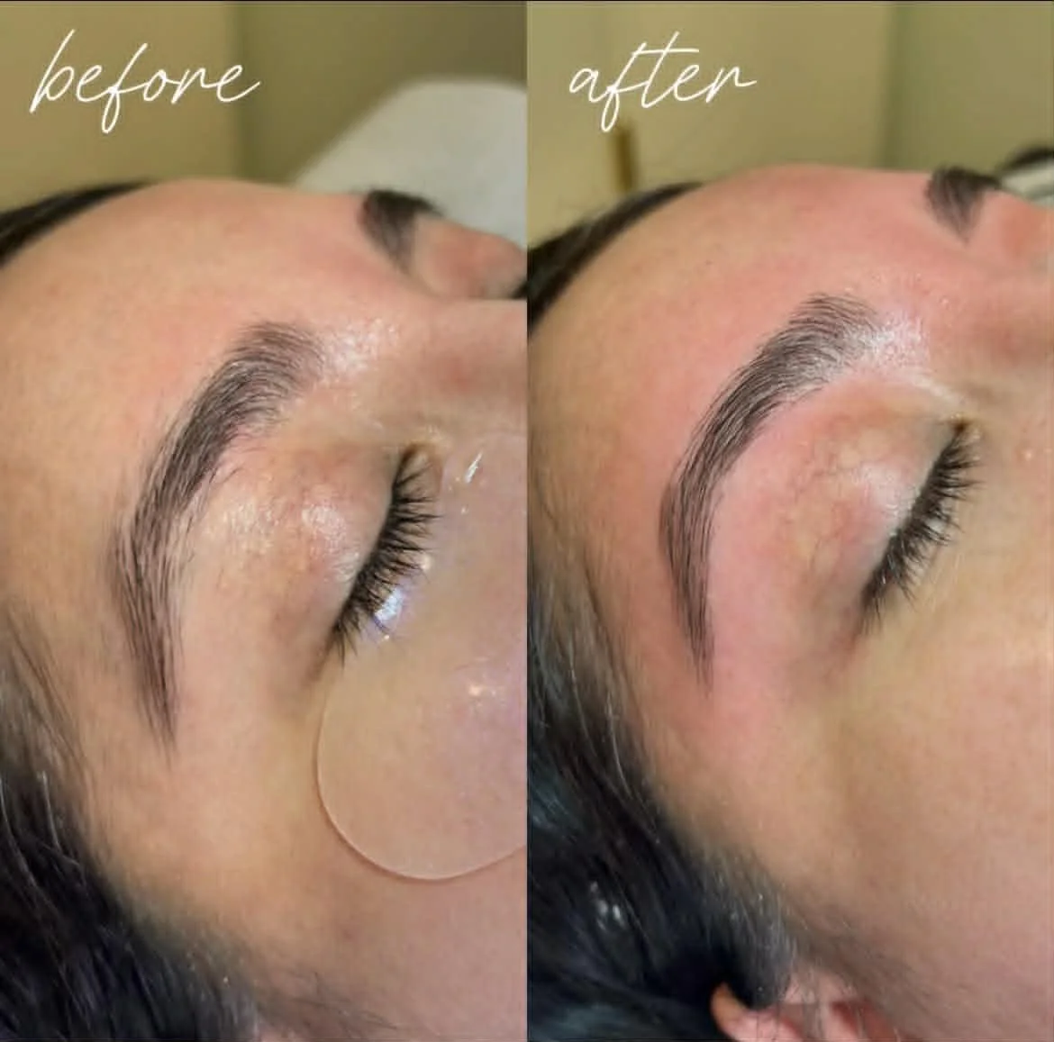 Close-up comparison of a woman's eyebrow before and after a cosmetic procedure showing fuller, more defined eyebrows after treatment.