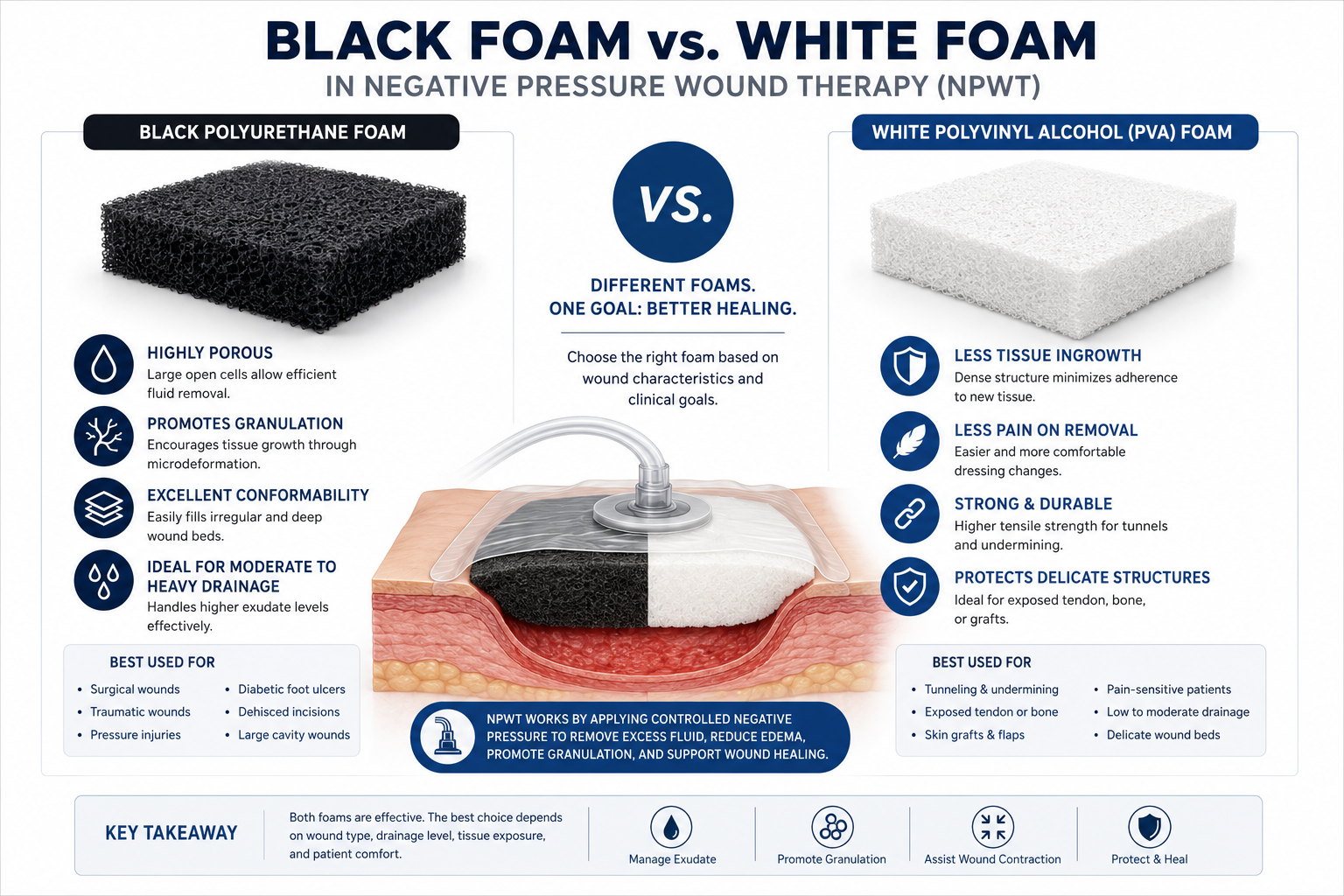 Black Foam vs. White Foam in Negative Pressure Wound Therapy: Which Dressing Should You Use?