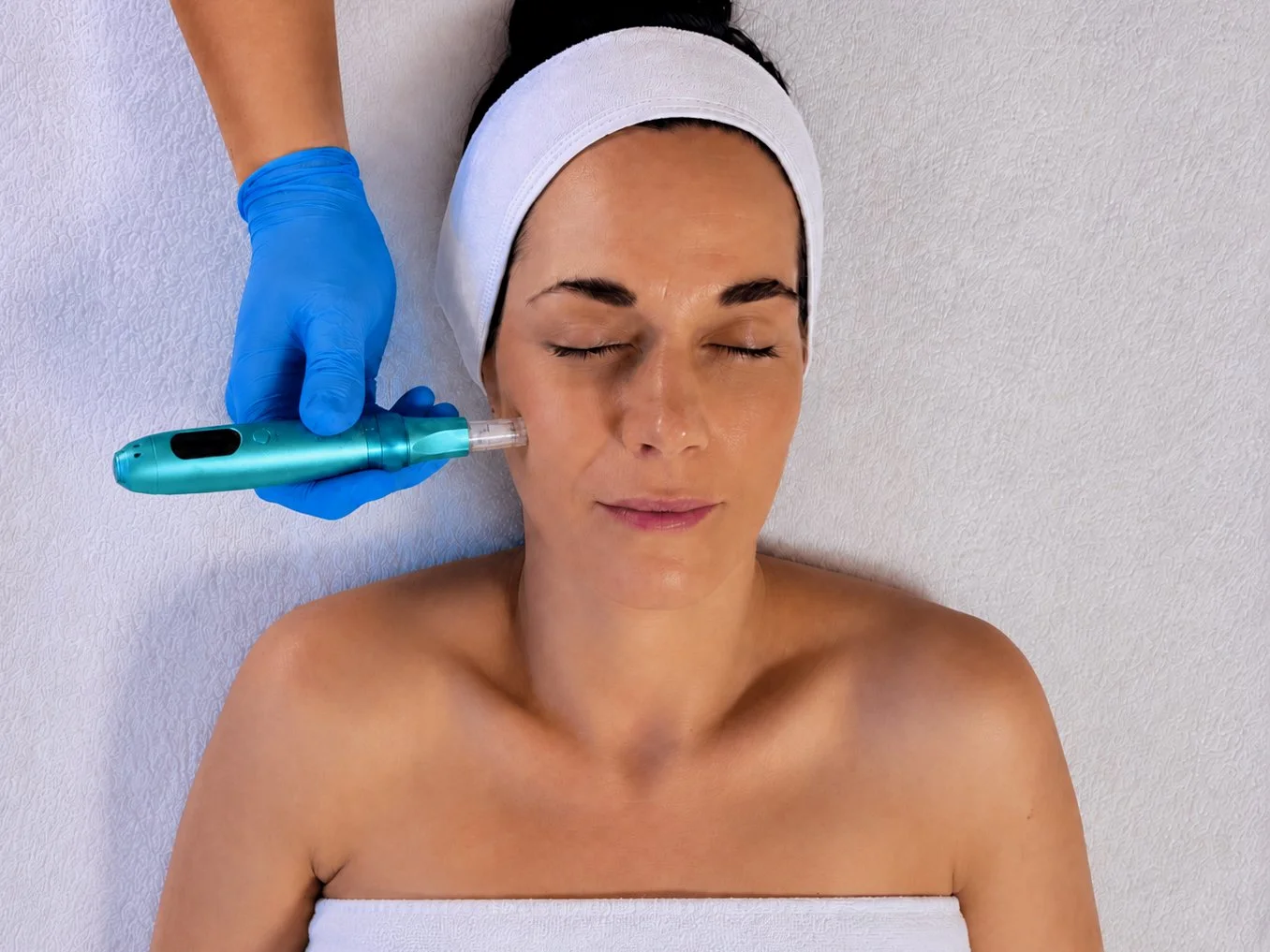 Frau erhält eine Microneedling-Behandlung im Kosmetikstudio Hautidee in Schwülper während sie entspannt mit geschlossenen Augen liegt.