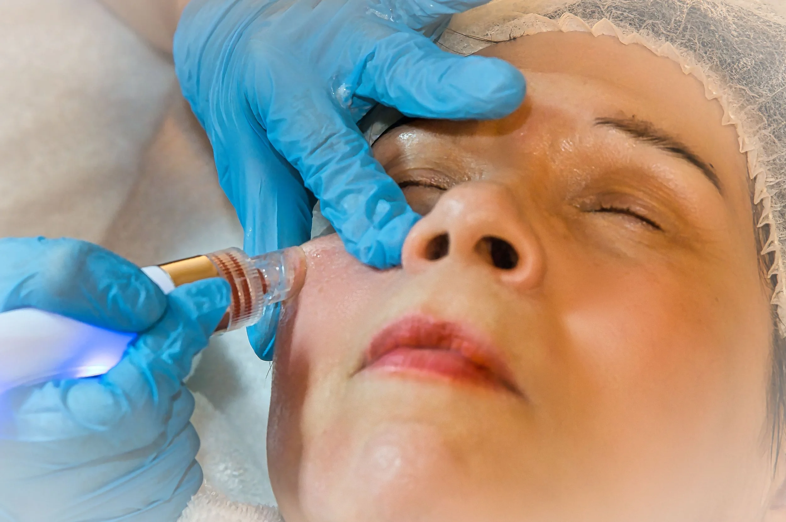 Eine Frau erhält eine Aquafacial-Deluxe-Behandlung im Kosmetikstudio Hautidee in Schwülper, während sie mit geschlossenen Augen entspannt ist.