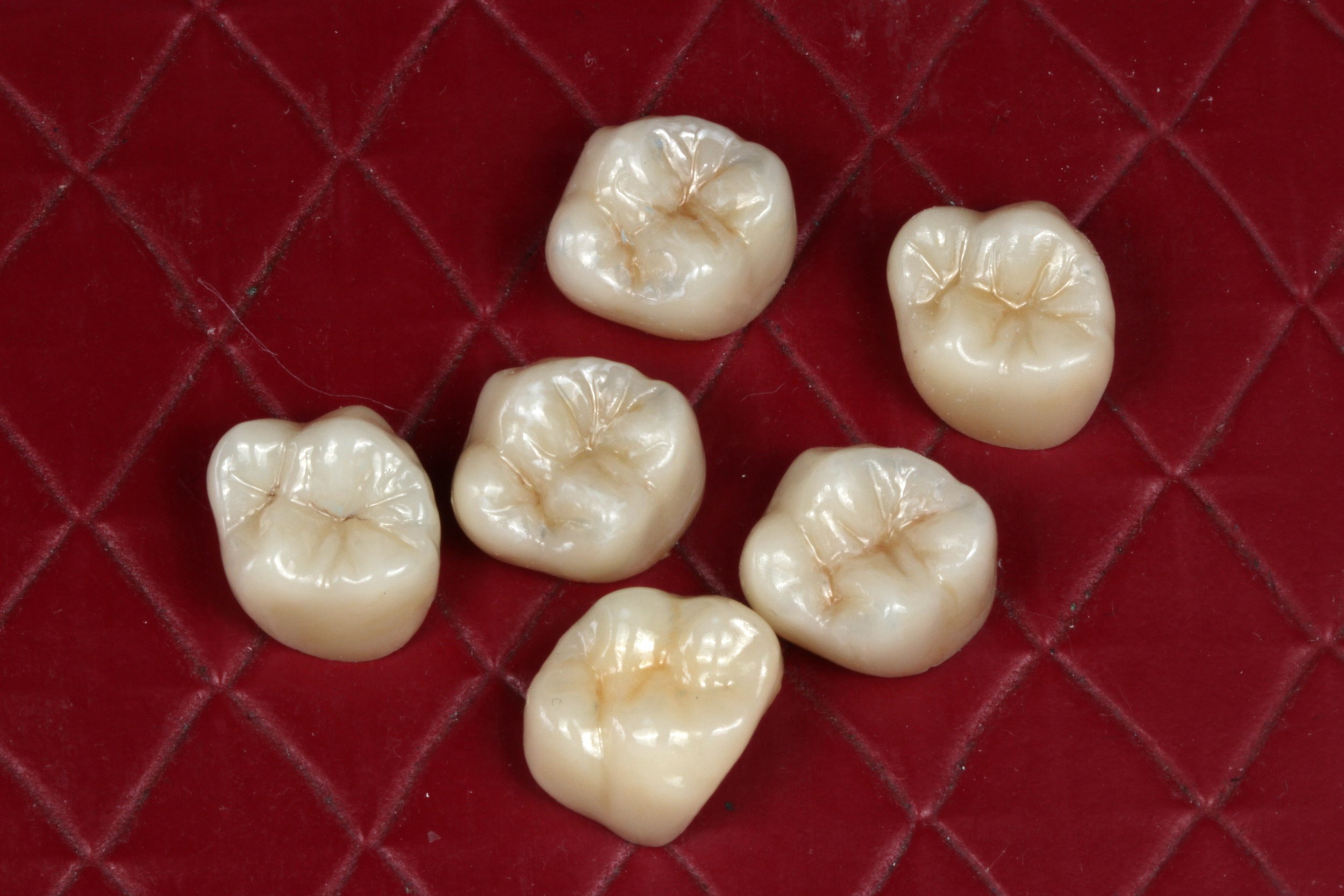 Monolithic Restorations- MiYO Liquid Ceramic at WSDL