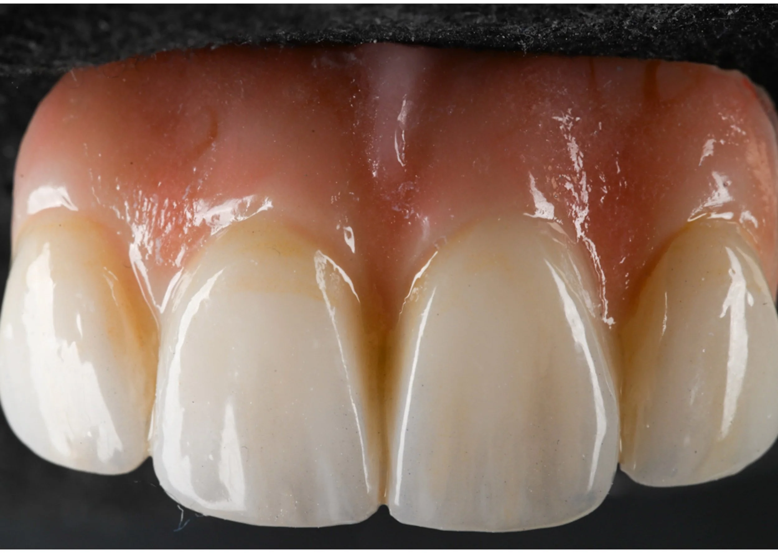 Close-up of the inside of a dental mold showing the teeth and gums in a dental setting.