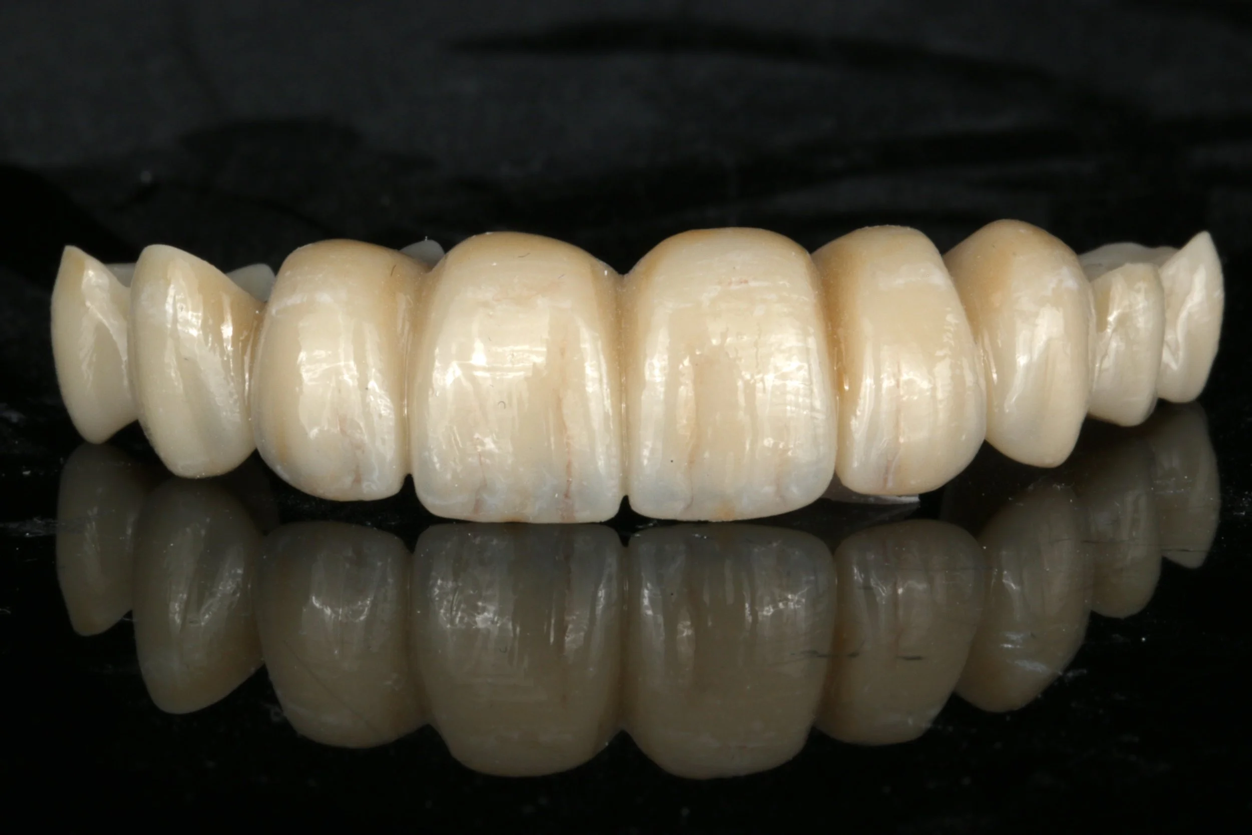 1 Day On-site - Monolithic Restorations or Zirconia Hybrids
