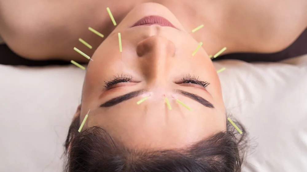 Facial acupuncture