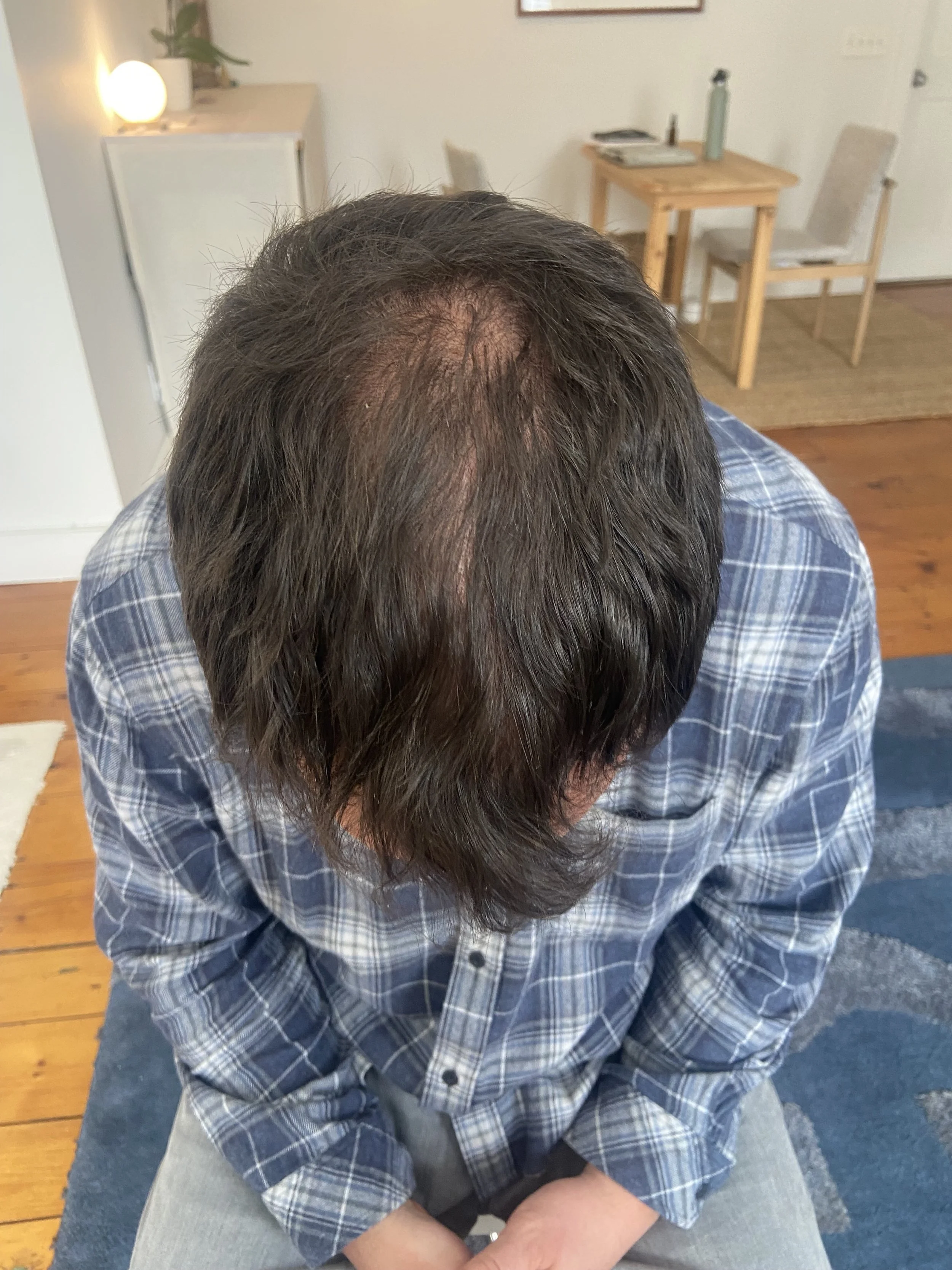 Micro Hair before.jpeg