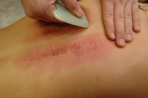 gua-sha photo.jpg