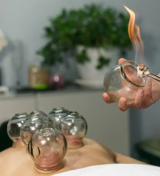 Cupping photo.jpeg
