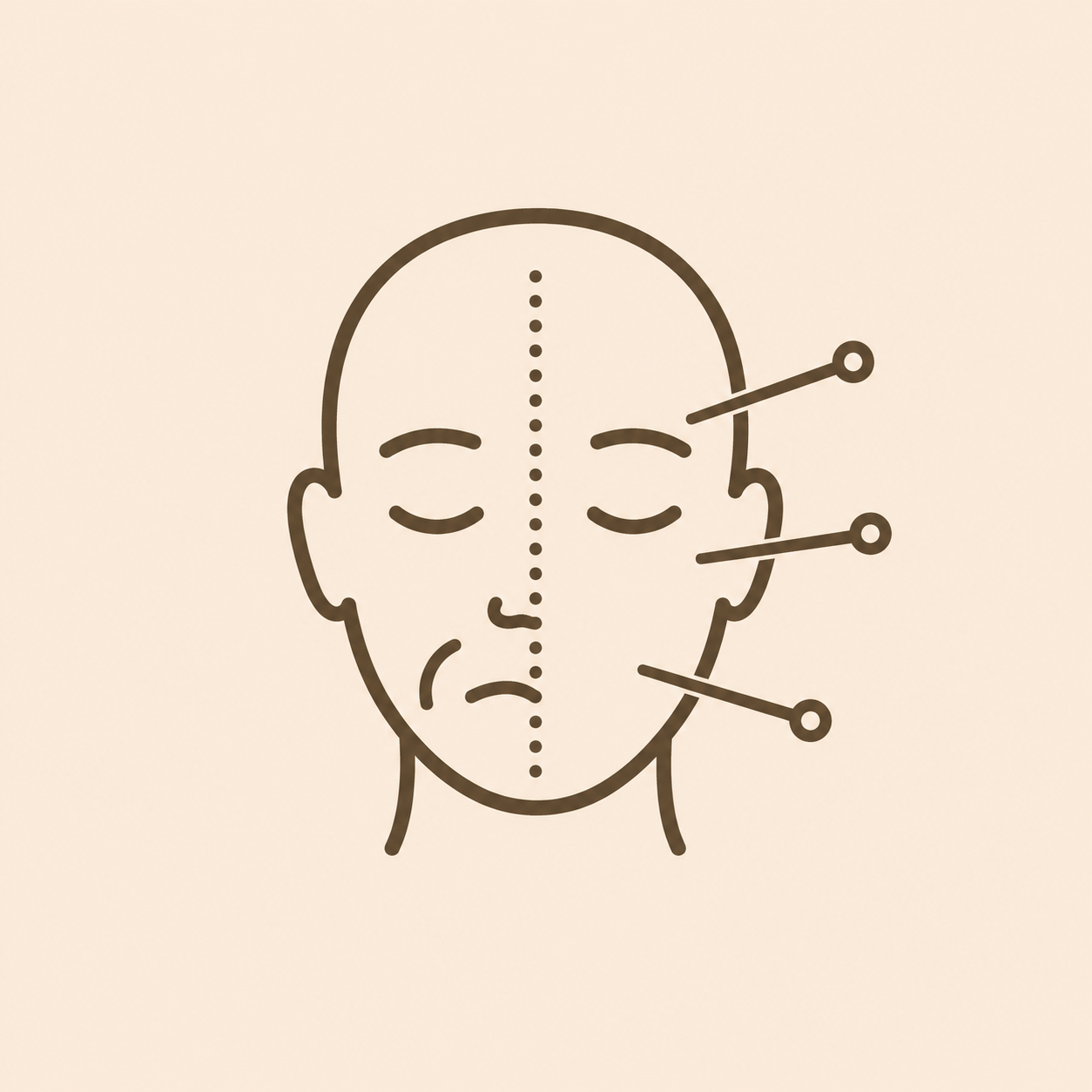 Outline drawing of a human face with closed eyes and a sad expression, with three acupuncture needles inserted into the right side of the face.