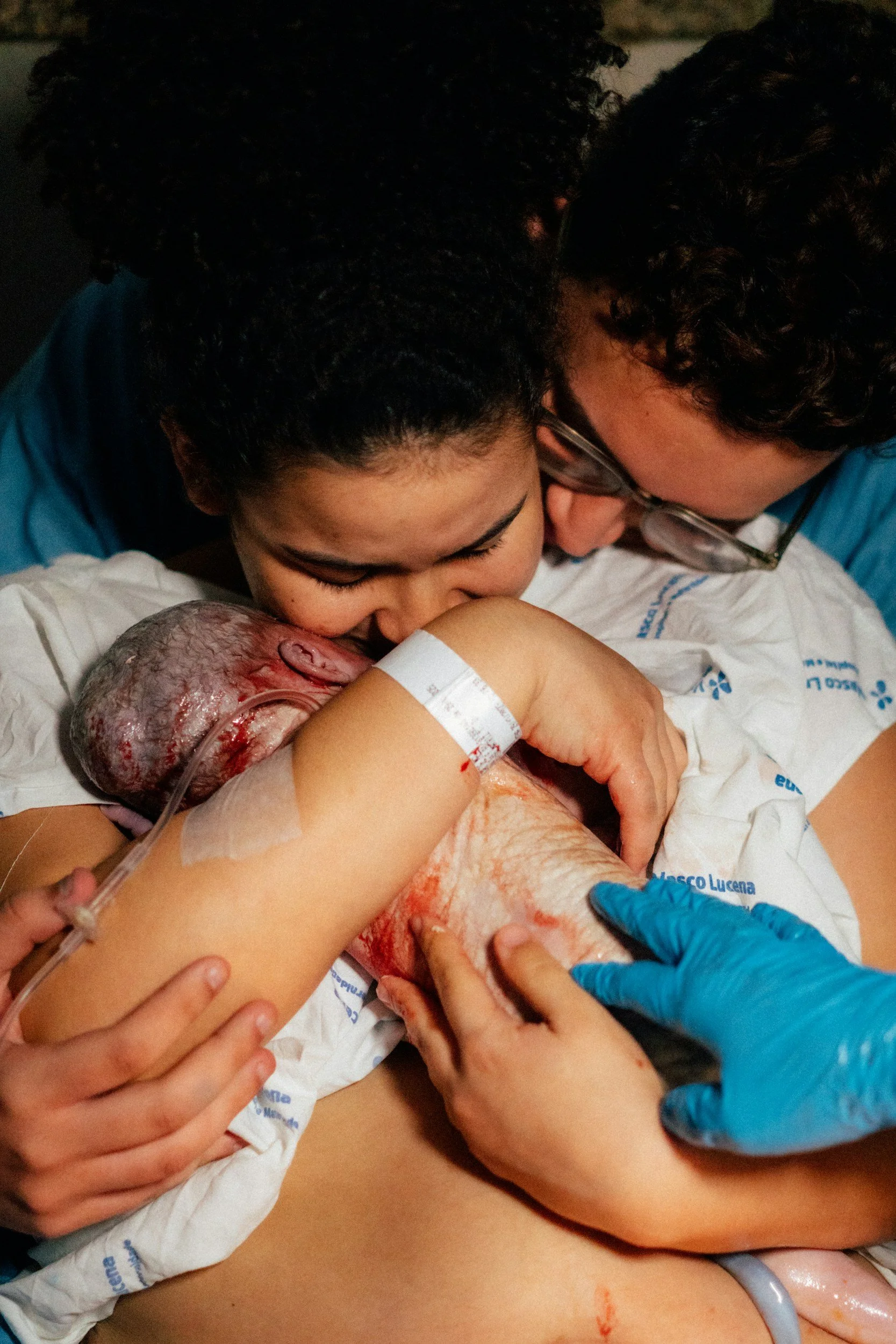 A group of medical professionals assists with a childbirth in a hospital. They are holding a newborn baby with a large head, likely a preterm infant, still attached to the umbilical cord, which is visible in the image.