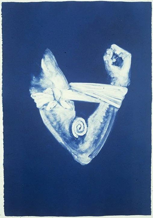 Untitled (bandaged arm), 1991, 30 x 22