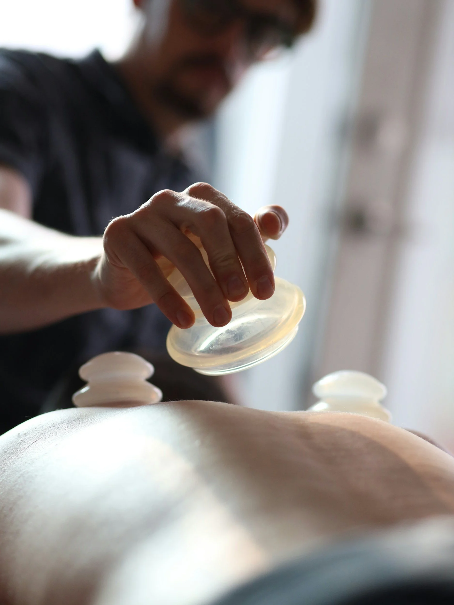A person is performing a massage or acupuncture therapy on a person's back, placing smooth stones or ceramic cups on their skin.