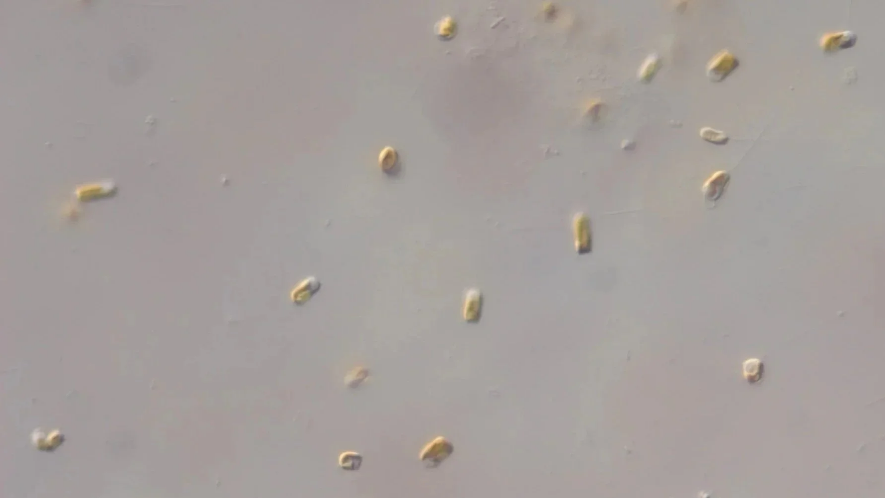Micrograph of Chaetoceros muelleri