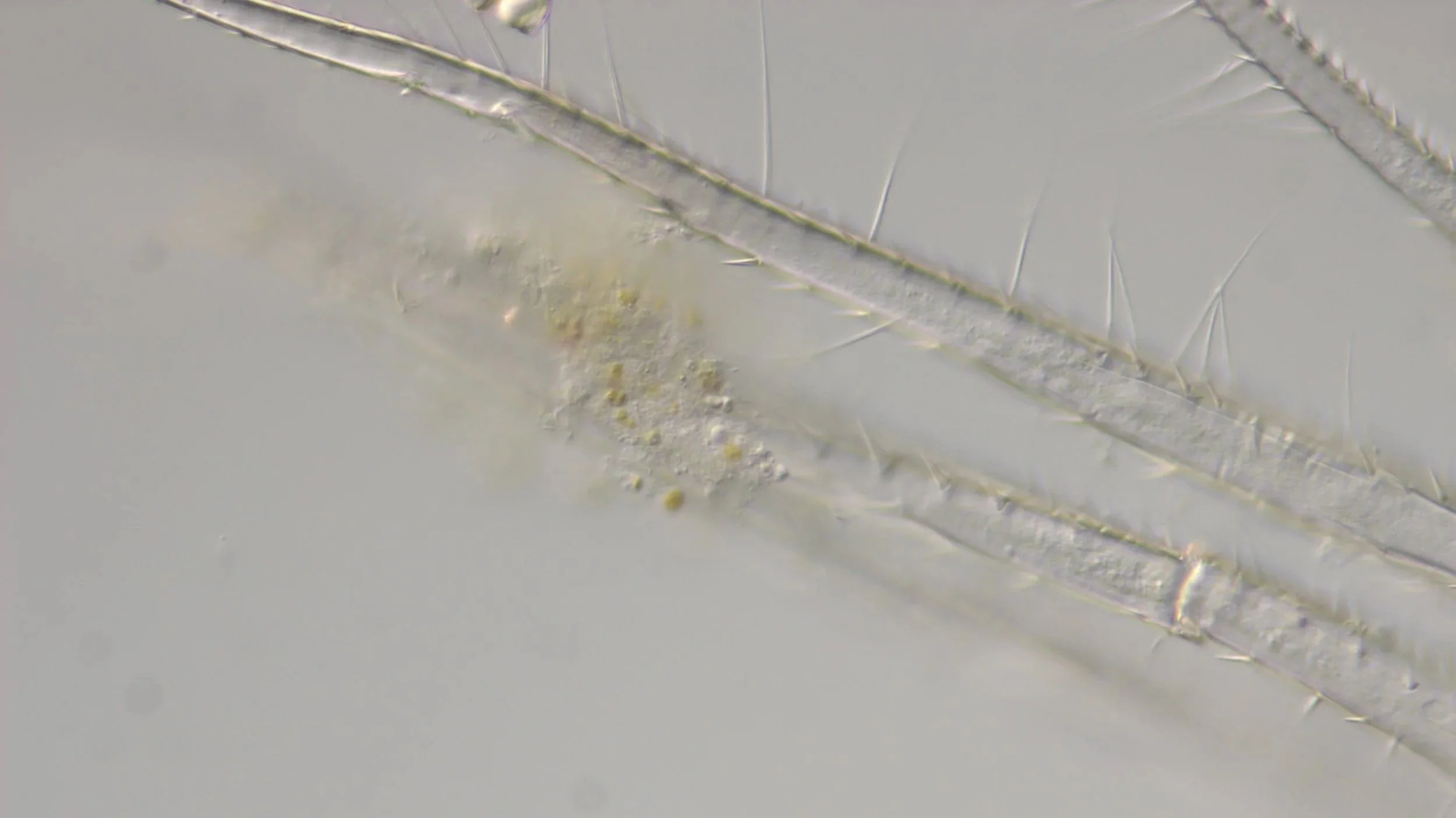 Bacteria and algae attached to shrimp larvae