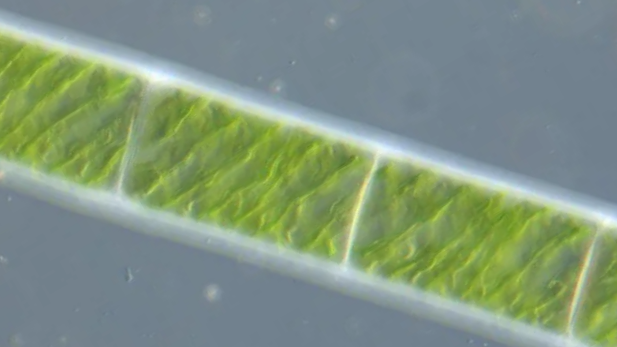 Micrograph of Spirogyra sp. filament.