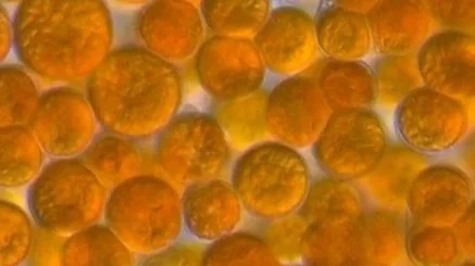 Microscopic image of orange in color Chlorella sp.