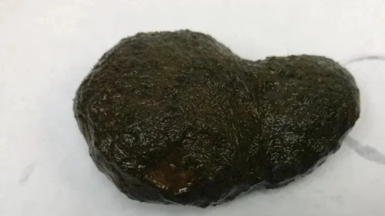 Rock covered with algae.