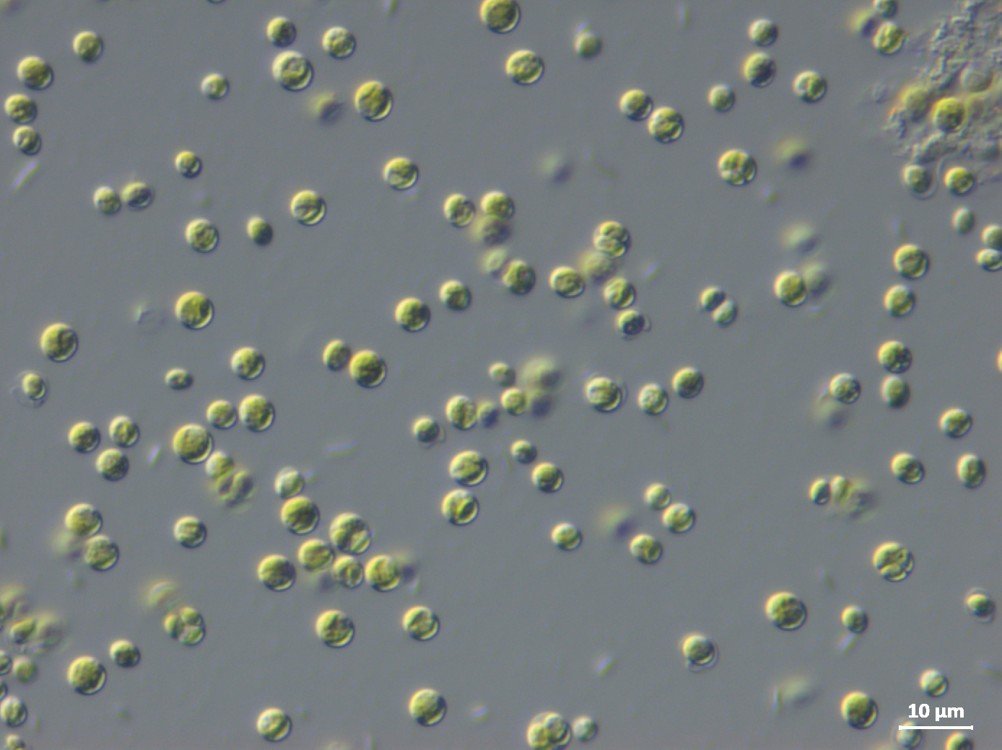 Microscope image of Chlorella sp.