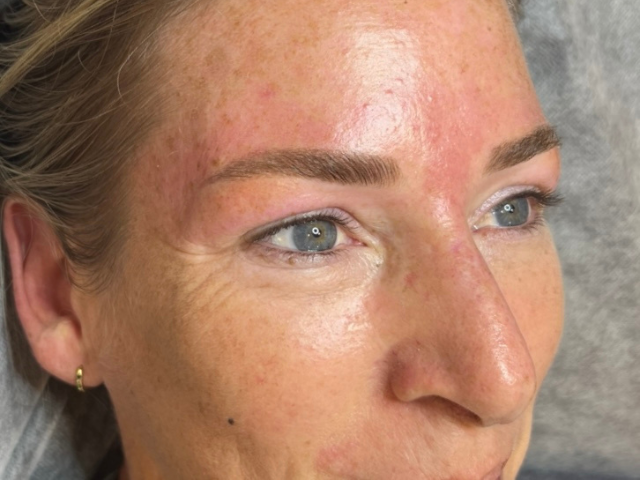 close up image of lady after cosmetic brow tattoo in melbourne