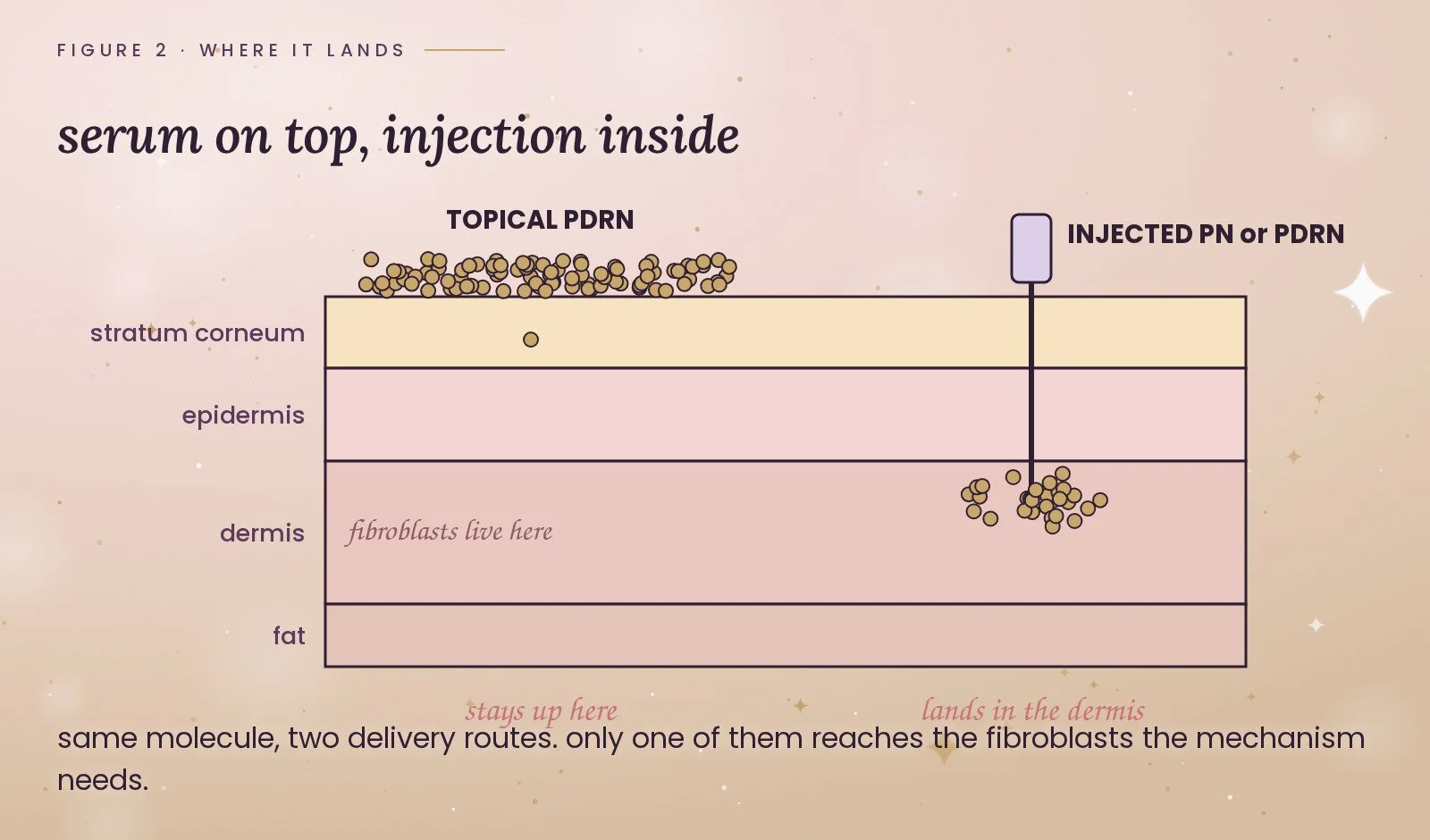 Figure 2, where it lands: a skin cross-section with topical PDRN piled on the stratum corneum and injected PN or PDRN delivered into the dermis where fibroblasts live