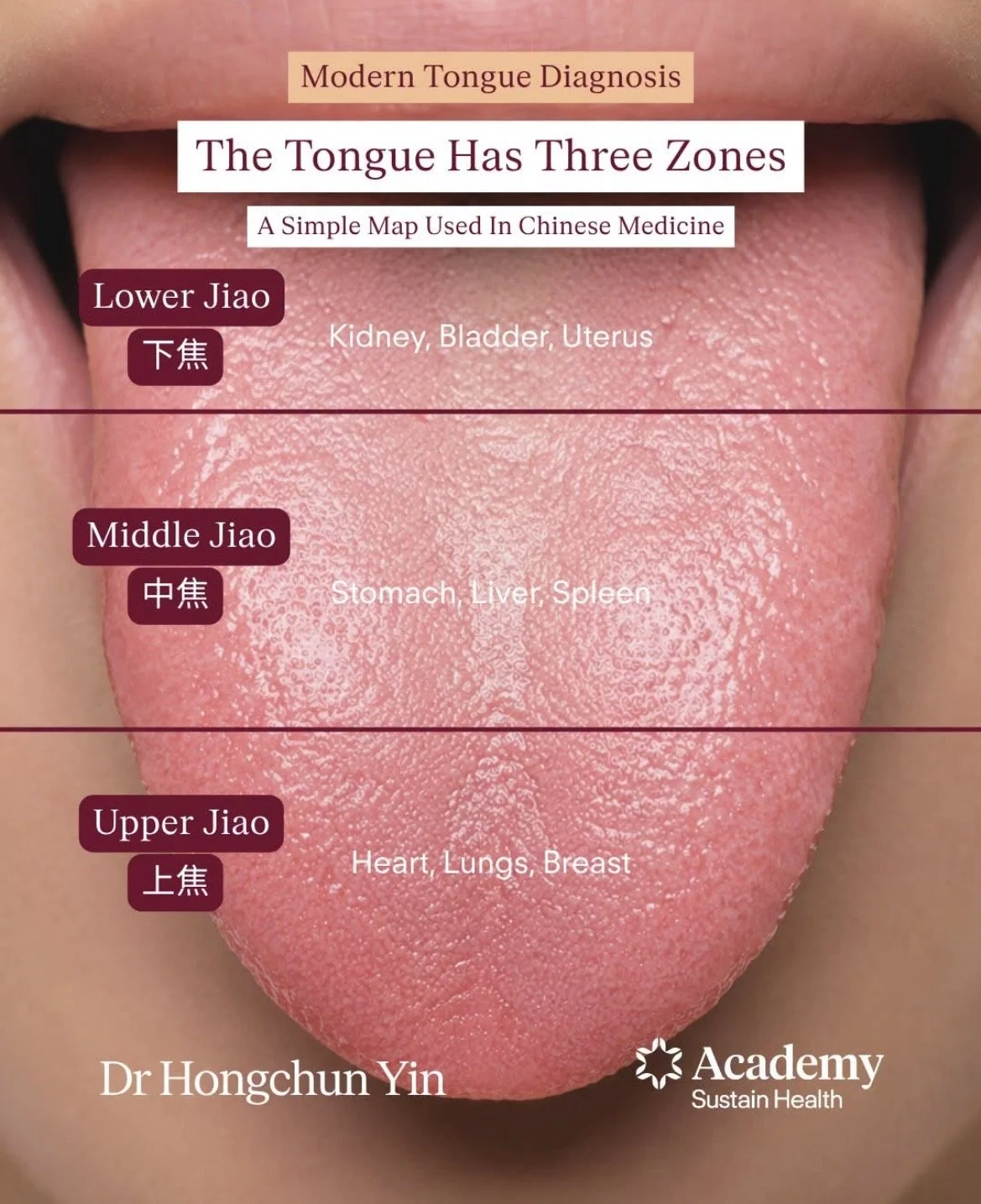 Why Does My Acupuncturist Look at My Tongue?