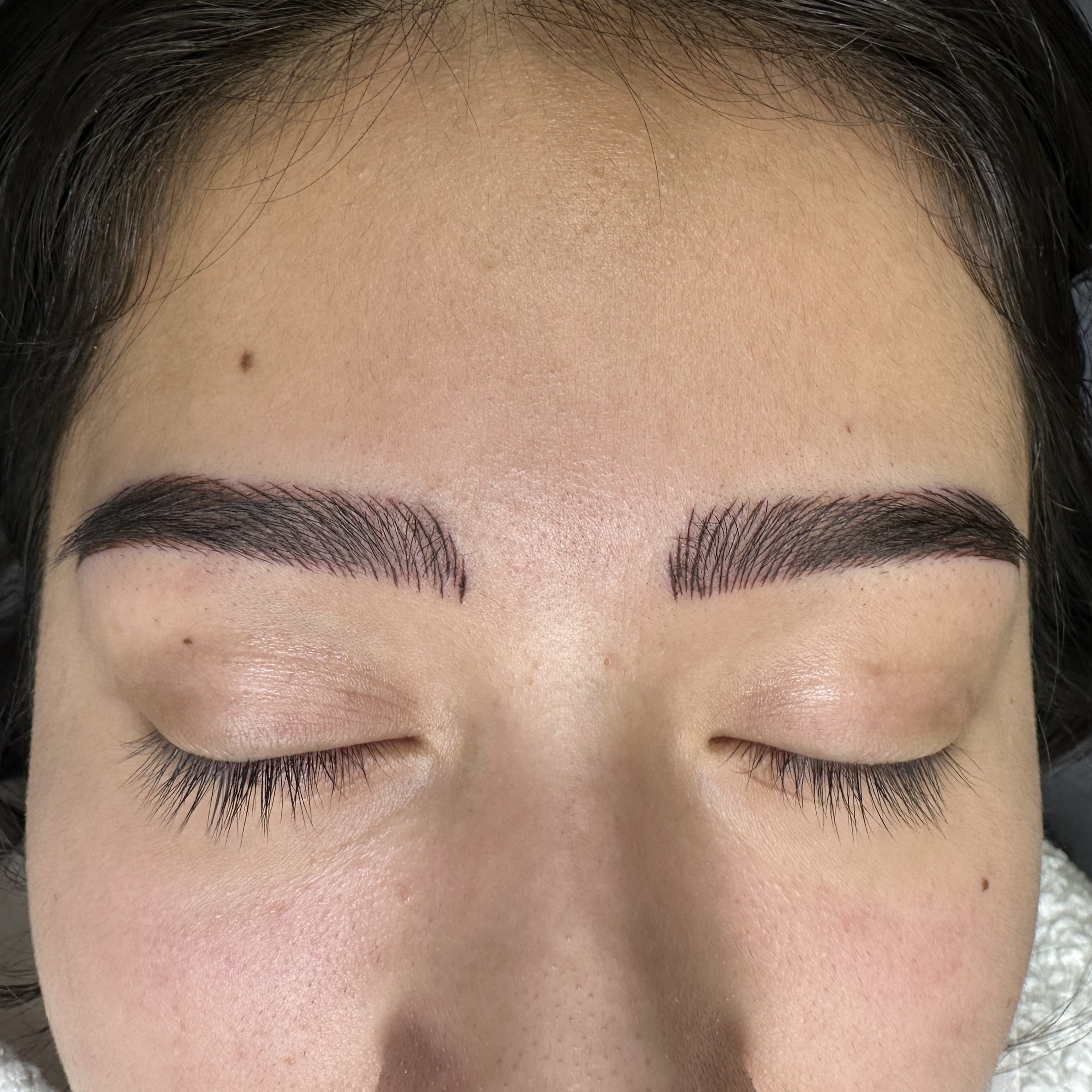 Emergency Removal - Before
