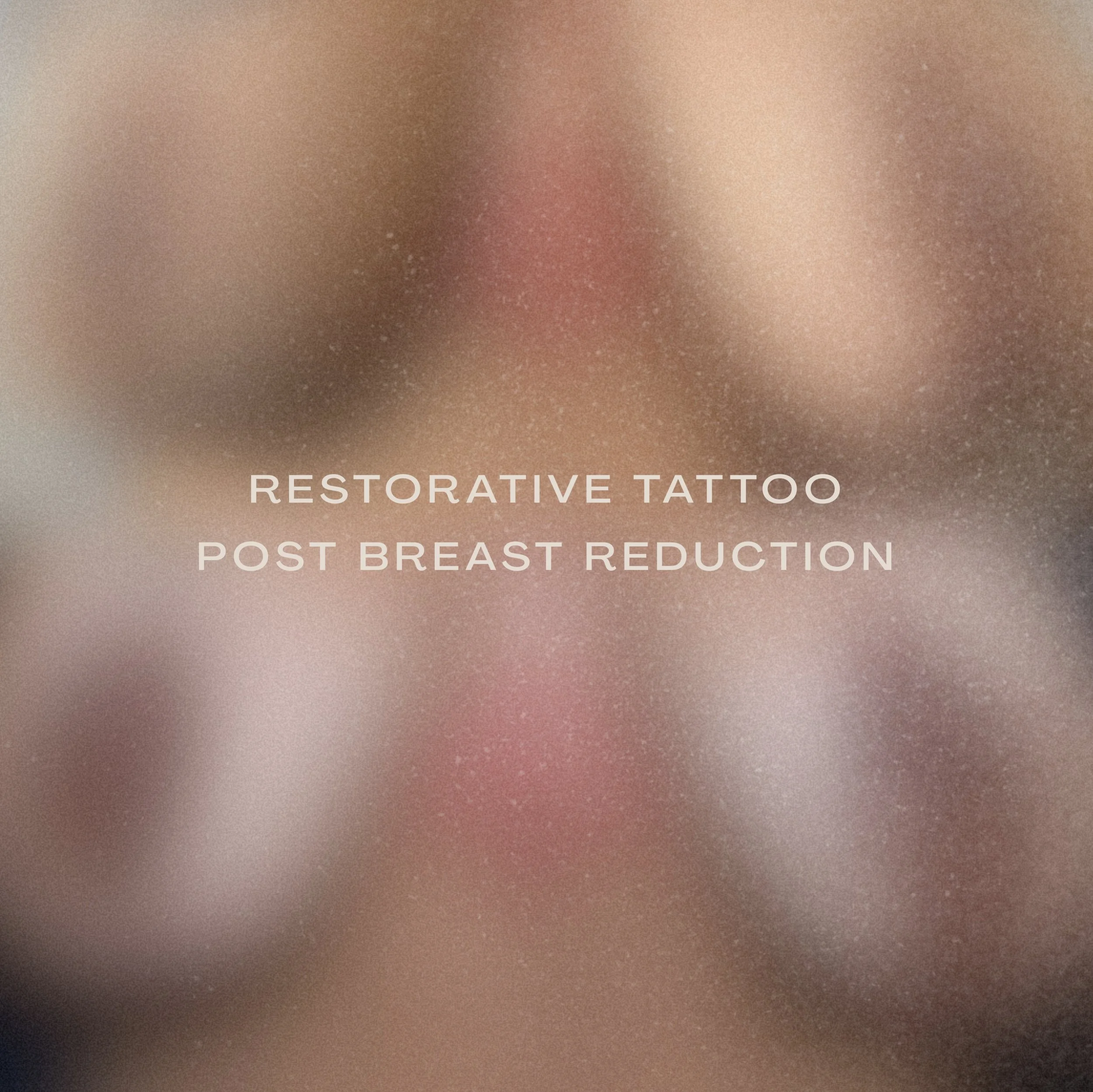 Areola Restoration | Before &amp; After ⁣
⁣
After a breast reduction, it&rsquo;s common for areolas to lose their shape and color along the edges, and it can feel defeating, especially after seeking help elsewhere without the results you hoped for.⁣
