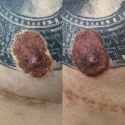 maleareola2.png