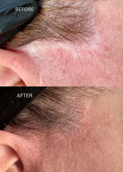 facelift5.png