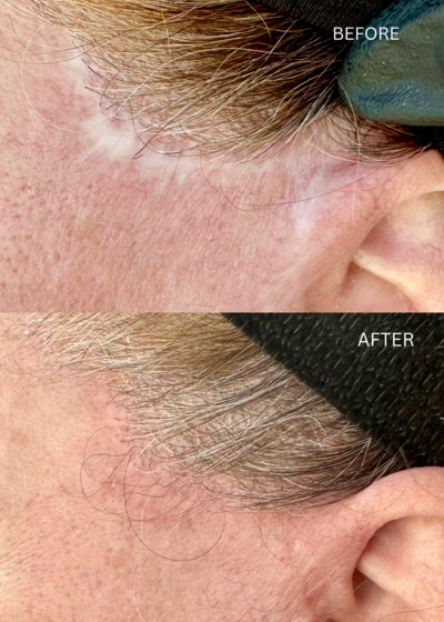 facelift4.png