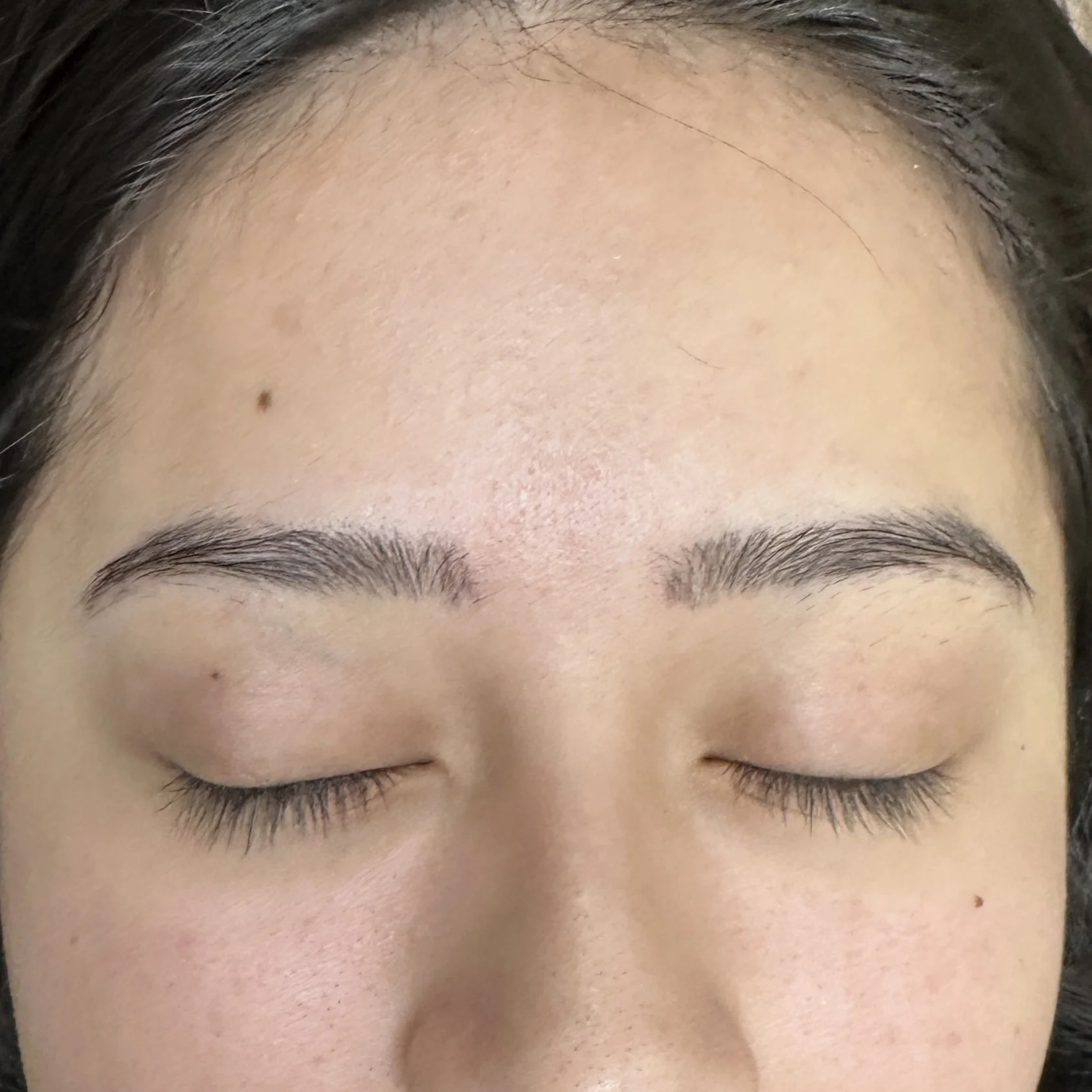Emergency Removal - After