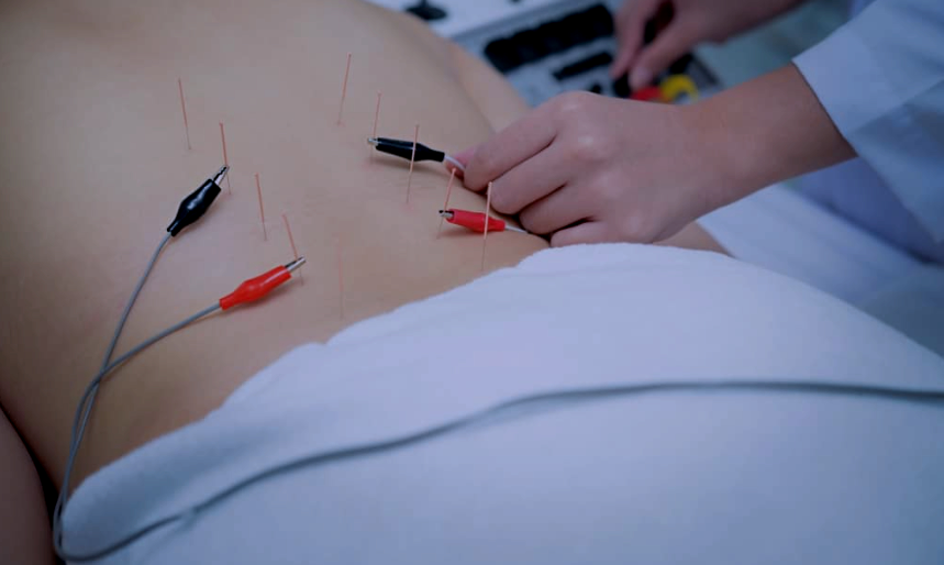 Electro- Stimulation