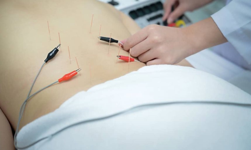 electro-acupuncture-neuropathy-rockville-maryland.png
