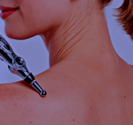 Needle-Free Acupuncture