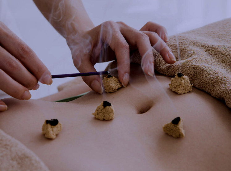Moxa Therapy