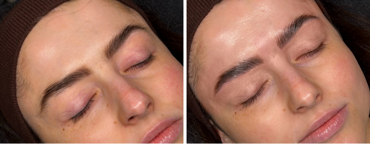 Close-up of a woman's face with eyes closed, showing before and after facial treatment or skincare application, highlighting improved skin condition and eyebrow grooming.