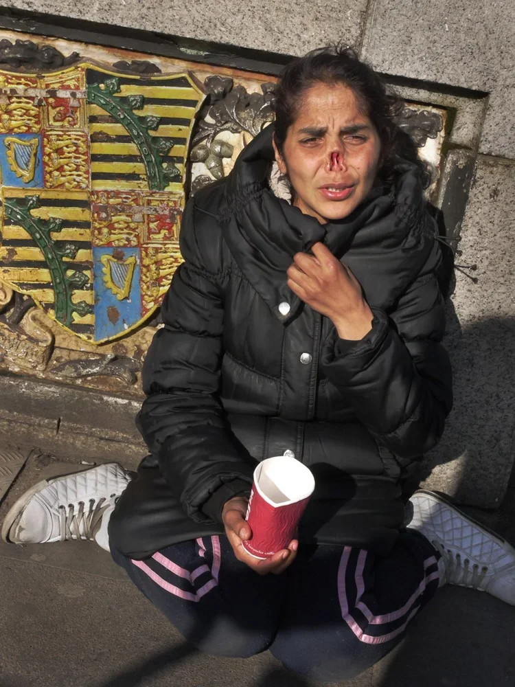 A woman sitting on the ground against a stone wall, with a hurt nose and face, holding a red paper cup, wearing a black puffy jacket and white sneakers.