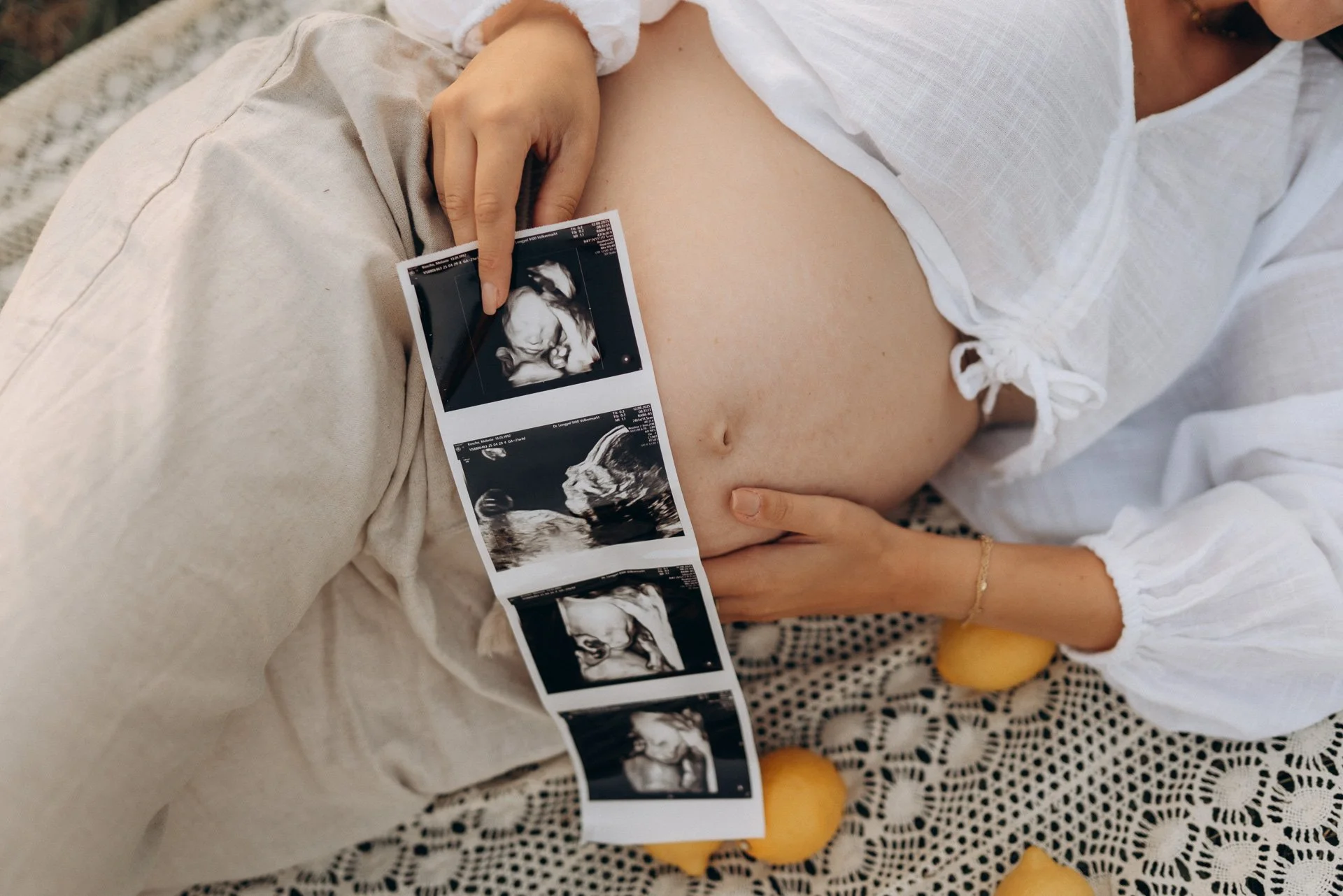 Eine schwangere Person liegt auf einem Strandtuch und hält eine Ultraschall-Postkarte mit mehreren Ultraschallbildern ihres ungeborenen Babys. Die Person trägt ein weißes Oberteil und ist von einer Person in neutraler Kleidung umgeben.