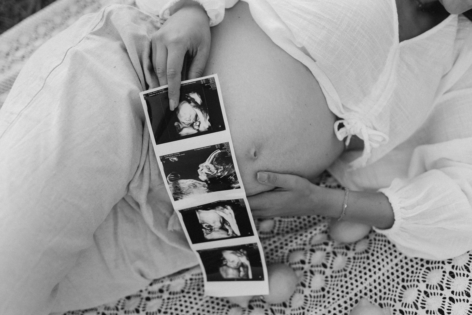 Schwangere Frau liegt im Krankenhausbett, hält Ultraschallbilder ihres Babys in der Hand.