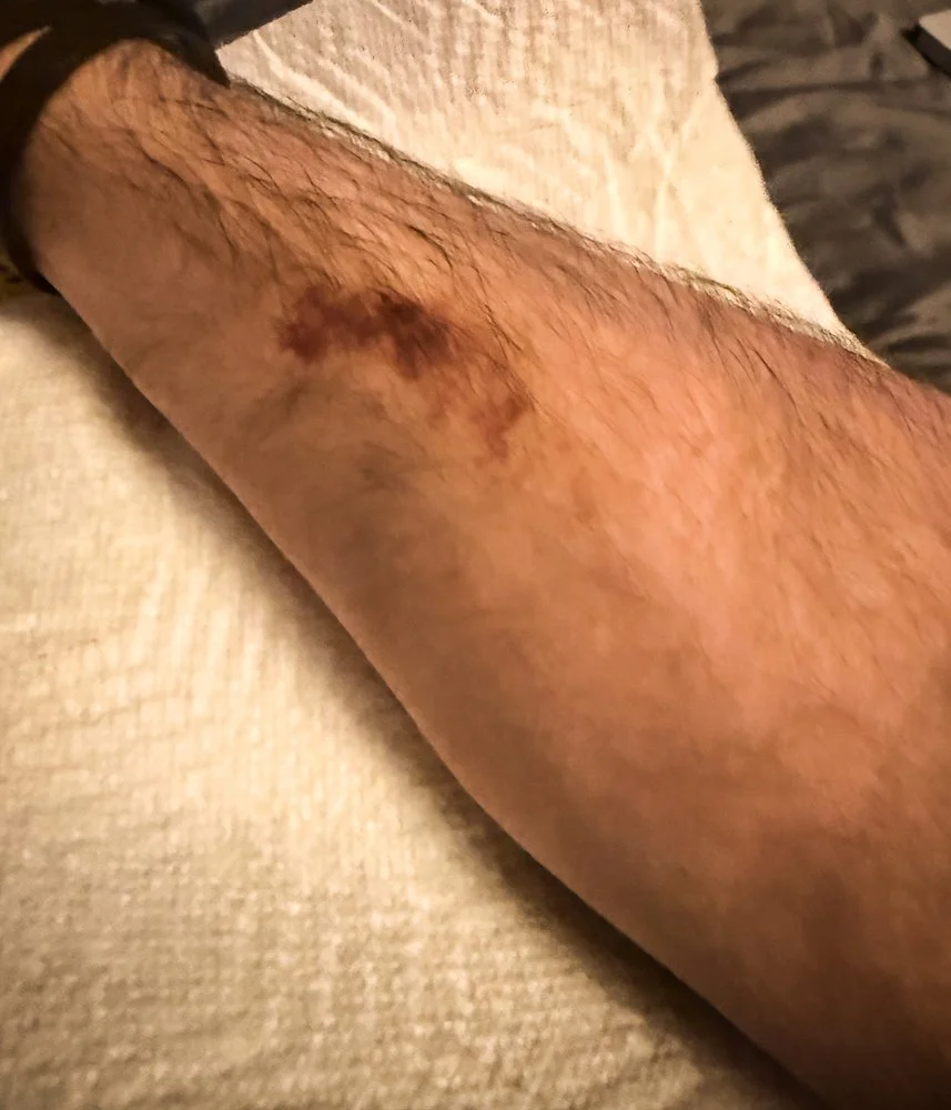 Hooked Up to Grace: What IV Antibiotics Taught Me About God